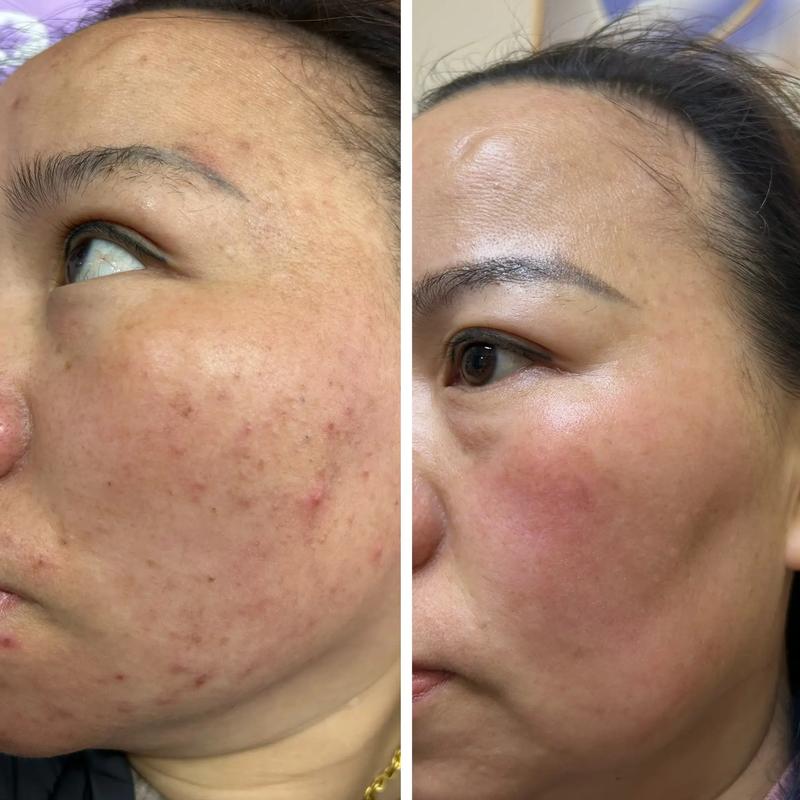 张玲美容：引领潮流的美妆新风尚