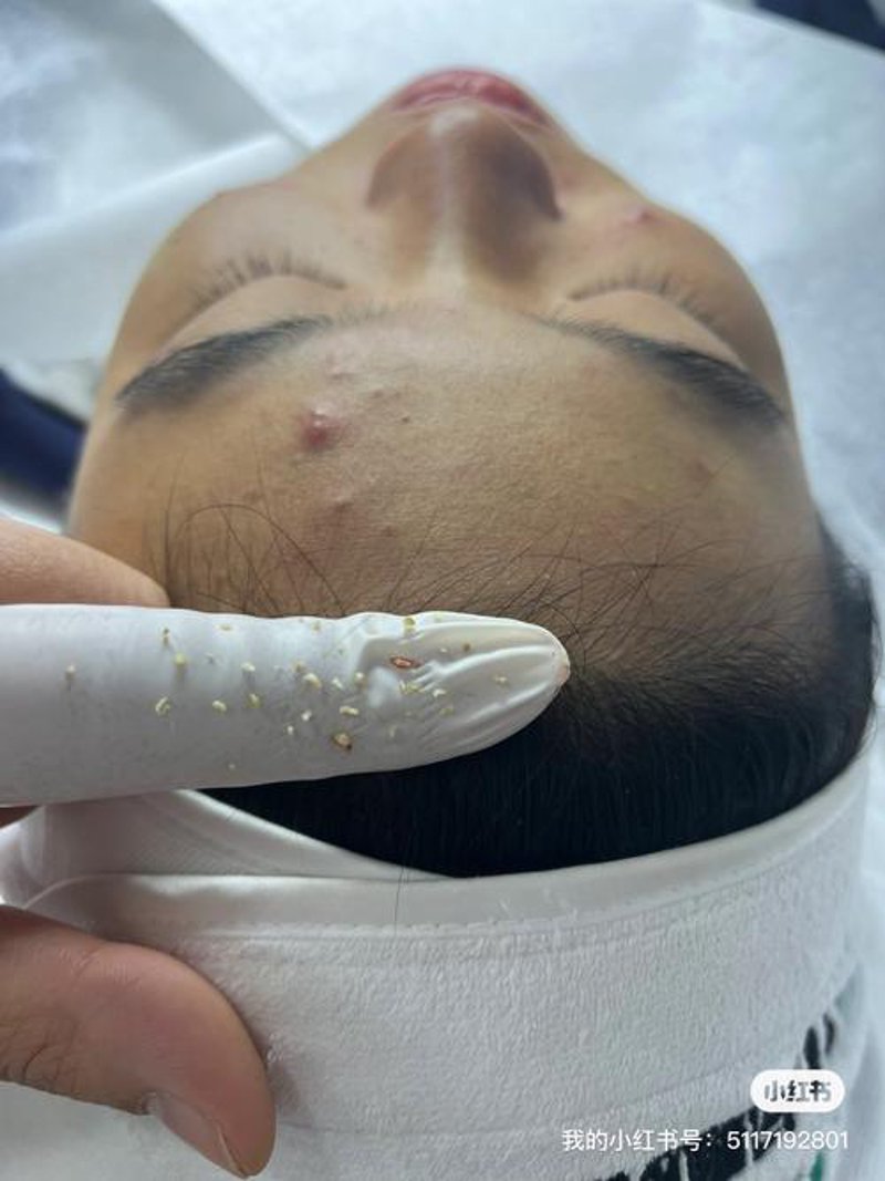 张玲美容：引领美丽新风尚
